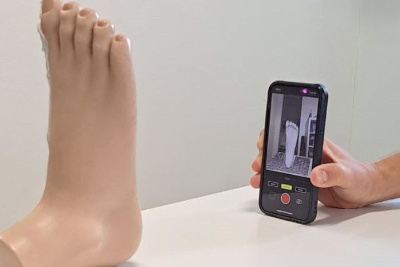 scansione 3D del piede